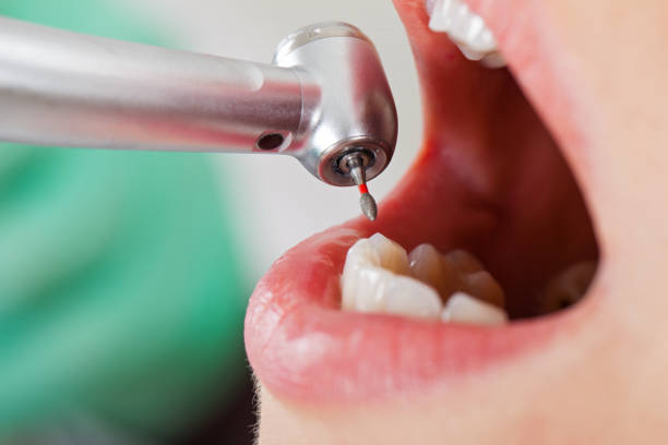 Best Emergency Denture Repair in Hamilton, MT